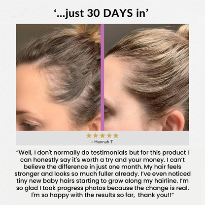 Hair Vitamin Gummies